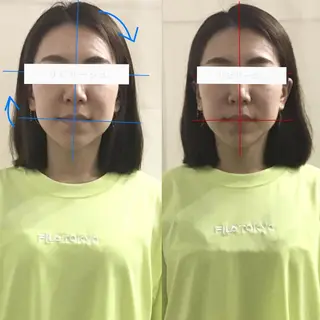 顔の歪み矯正専門 宮内翔のエステ・リラクイメージ