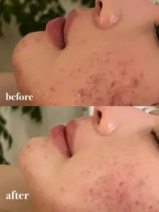 ohana所属・河合 菜月のエステ・リラクイメージ