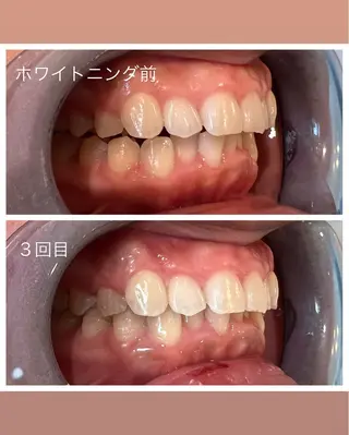 セルフホワイトニング Shineeのエステ・リラクイメージ