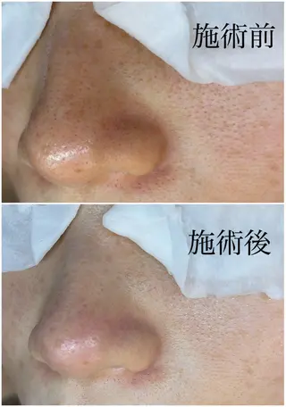 姫路/毛穴専門店 'AMOのエステ・リラクイメージ