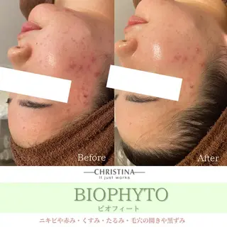 メンズ hu・ruana aesthetic salon所属・高木 楓の眉毛・アイブロウイメージ