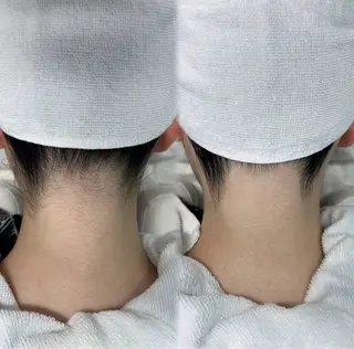 けいこ꙳✧˖° 脱毛のエステ・リラクイメージ