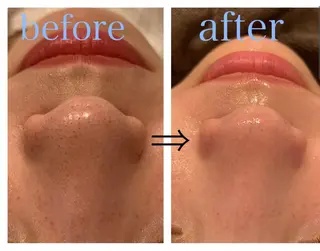 リジュベ所属・Rejuve ﾘｼﾞｭﾍﾞのエステ・リラクイメージ