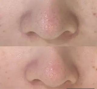 DeI'm   名古屋栄所属・小林 玲菜のエステ・リラクイメージ