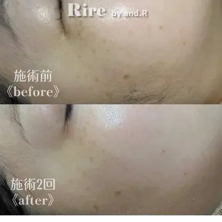 実方 梨々花のエステ・リラクイメージ