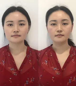 美容鍼・小顔/ 骨盤矯正/目黒/レンのエステ・リラクイメージ