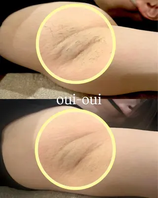 oui-oui　ウィウィ所属・oui-oui 磐田脱毛のエステ・リラクイメージ