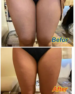 BeautySalon　heart所属・Beauty Salonheartのエステ・リラクイメージ