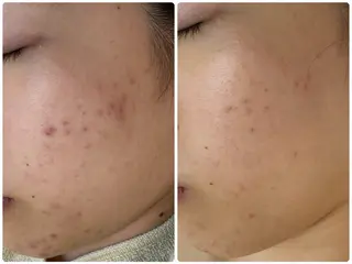 シミ毛穴専門店 yucca(ユッカ)のエステ・リラクイメージ