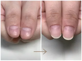 ネイル 深爪矯正・自爪育成 ヴェールリムのネイルデザイン