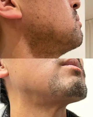 メンズ メンズビューティー 池村哲雄のエステ・リラクイメージ