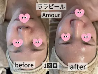 痩身・小顔・脱毛・ オイル&Amourのエステ・リラクイメージ
