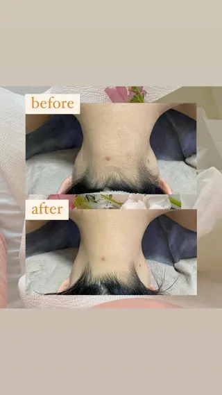 crescent所属・【韓国肌管理・脱毛】 クレセントのその他イメージ