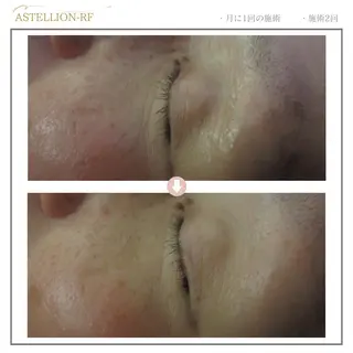 Sylphya (シルフィア)のエステ・リラクイメージ