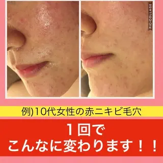 ミディアム カラー パーマ ヘアアレンジ メンズ キッズ ネイル マツエク・マツパ ニキビ・肌質改善専門 ♡人生が変わるサロンのエステ・リラクイメージ