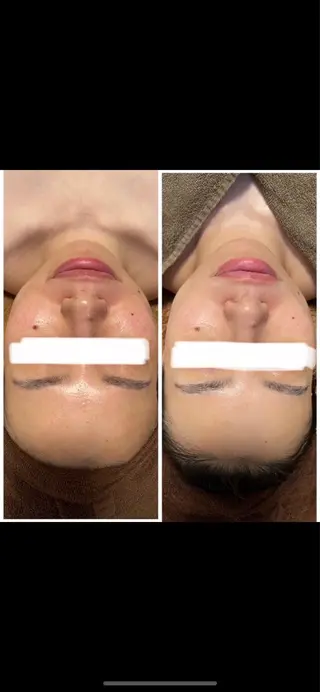 メナードフェイシャルサロン LORO所属・メナードフェイシャル サロンLOROのエステ・リラクイメージ