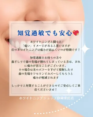 ホワイトニングショップ静岡葵区店所属・ホワイトニング ショップ葵区静岡駅店のその他イメージ