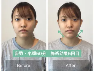 美容整体　小顔矯正 プラスフィール青田のエステ・リラクイメージ