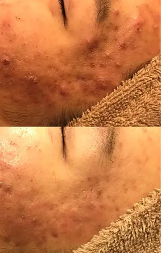 メンズ 毒素出し専門サロンSylph(なかがわ整骨院併設サロン)所属・Mami Hataのエステ・リラクイメージ