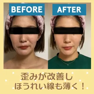 小顔矯正サロン プルメリアのエステ・リラクイメージ