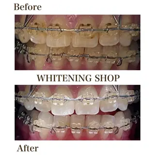 ホワイトニングショップ伊丹店所属・ホワイトニング ショップ伊丹店のその他イメージ