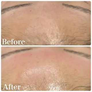 ハーブ&艶肌ワックス re:proのエステ・リラクイメージ