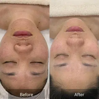 すっぴんたまご肌 平木さやかのエステ・リラクイメージ