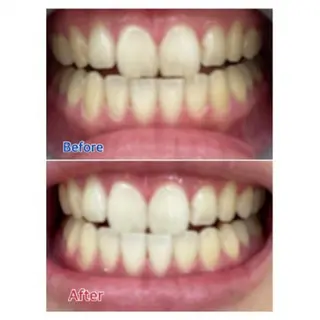 M渋谷店所属・Ｍ渋谷 ホワイトニングのエステ・リラクイメージ