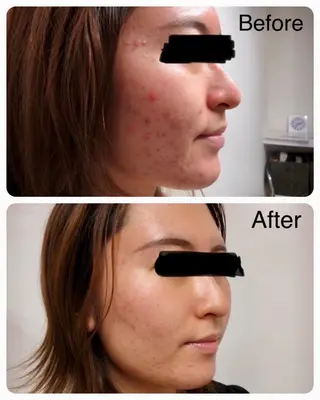 Espoir /エスポワール所属・三澤 秀基のエステ・リラクイメージ