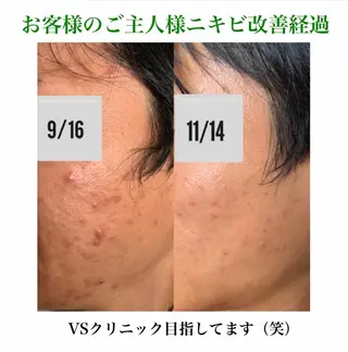 a  room salonのエステ・リラクイメージ