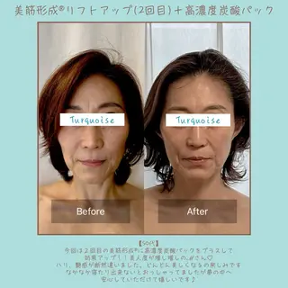 フェイシャルエステ Turquoiseのエステ・リラクイメージ
