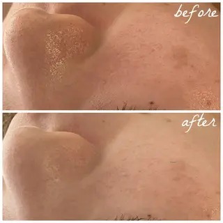 メンズ メナード岐阜茜部 杉浦のエステ・リラクイメージ