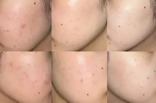 韓国肌管理Belle堀江所属・韓国肌管理 Belle堀江のエステ・リラクイメージ