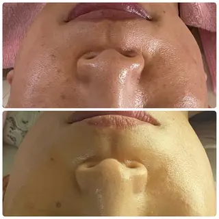 Salon Rion所属・Rion 野々村のエステ・リラクイメージ