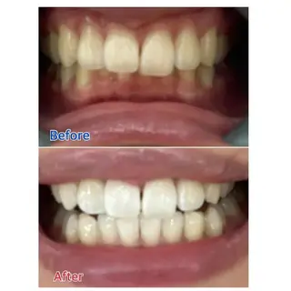 M渋谷店所属・M渋谷 ホワイトニングのエステ・リラクイメージ