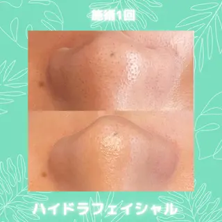 Emu beautysalon所属・Emu beauty salonのエステ・リラクイメージ