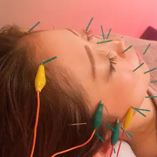 表参道 ポルクス整骨院のエステ・リラクイメージ