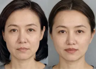 ネイル aliaハイフ&水光ジェットサロン所属・aliaハーブ水光店 エステティシャン募集のエステ・リラクイメージ