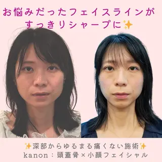 小顔矯正サロン町田 逸見智美のエステ・リラクイメージ