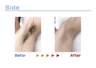 セルフ脱毛/美尻イス キングスサロン熊本のエステ・リラクイメージ