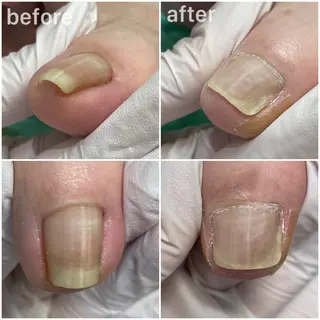 東京巻き爪アカデミー所属・東京巻き爪 アカデミーのエステ・リラクイメージ