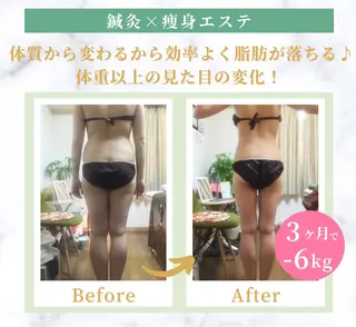 美容鍼灸師 齋藤 麗子のエステ・リラクイメージ