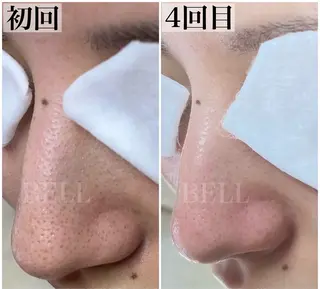 BEAUTY SALON BeLL所属・毛穴ケア専門店 BeLL ベルのエステ・リラクイメージ