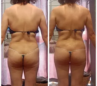 charmant (シャルマン)所属・エステサロン charmantのエステ・リラクイメージ