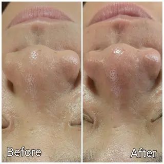 山城 悠菜のエステ・リラクイメージ