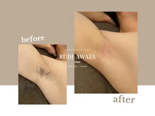 全身脱毛&ブラジリアンワックスサロン rudi 【ルディ】阿波座店所属・【脱毛/眉毛専門店】 rudi　阿波座店の眉毛・アイブロウイメージ