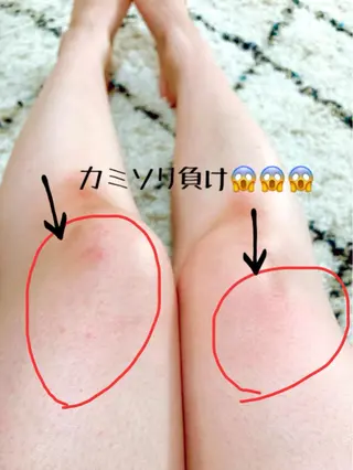 セルフ脱毛アトリエao.所属・セルフ脱毛 atelier aoのエステ・リラクイメージ