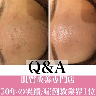 ミディアム カラー パーマ ヘアアレンジ メンズ キッズ ネイル マツエク・マツパ ニキビ・肌質改善専門 ♡人生が変わるサロンのエステ・リラクイメージ