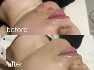 M FLOAT skin salonのエステ・リラクイメージ