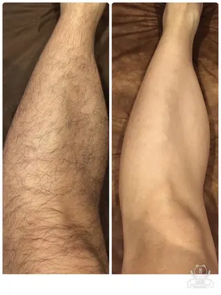 メンズ キッズ 脱毛・美肌サロン Epi Houseのエステ・リラクイメージ